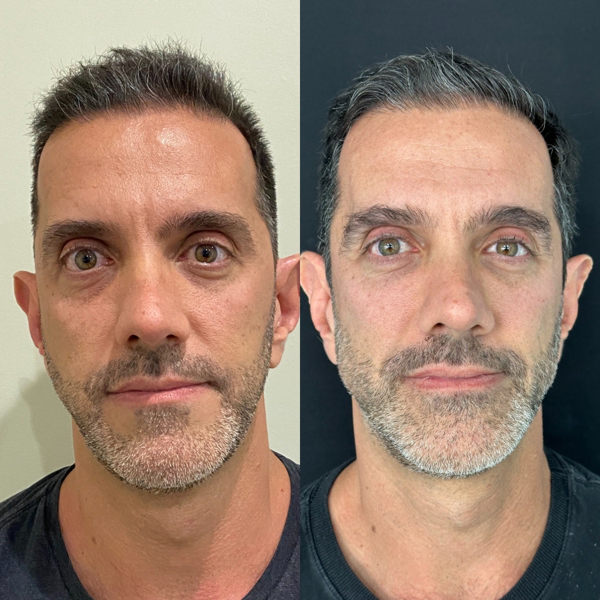 Processed with MOLDIV